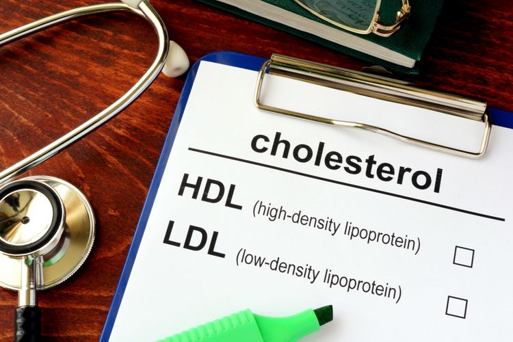 Cara Alami Turunkan Kolesterol dari Ahli Gizi Unpad